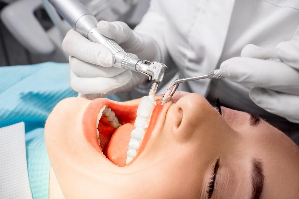 Essential Tips for Maintaining Optimal Dental Health