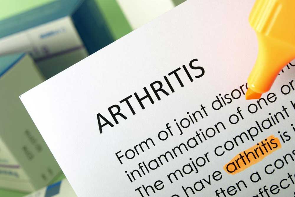 Natural Strategies to Alleviate Persistent Arthritis Pain Effectively