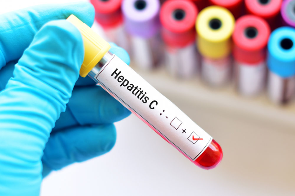 Understanding Hepatitis: Types and Risk Factors