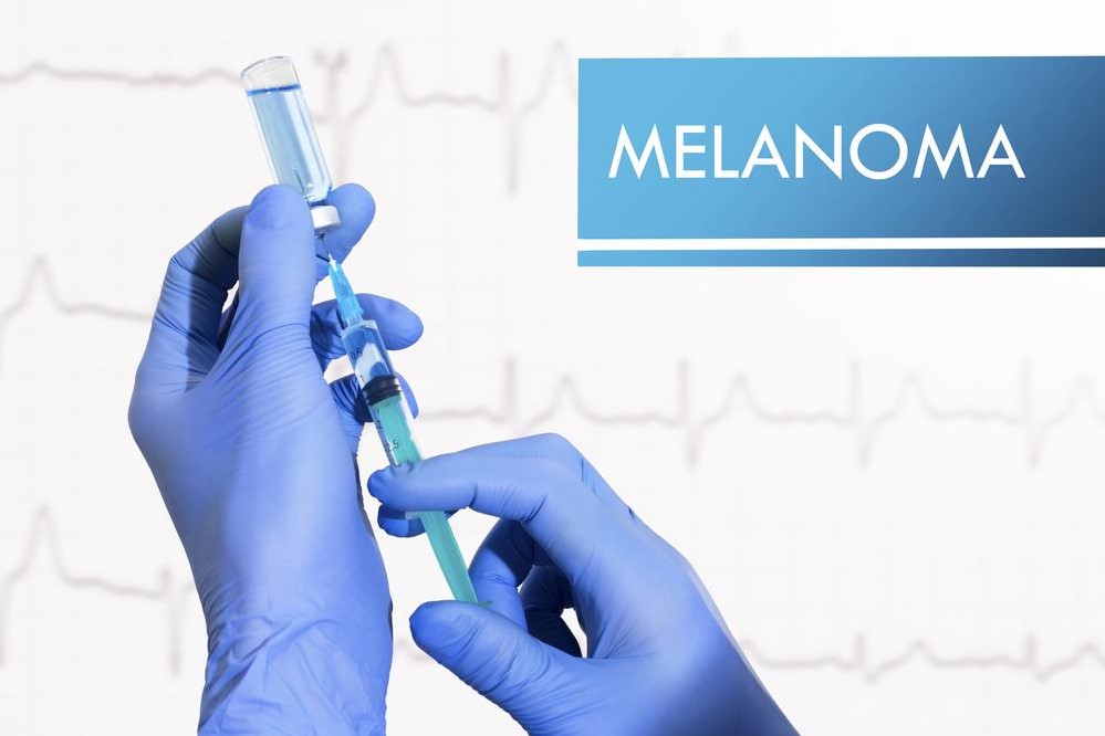 Comprehensive Guide to the Top 6 Risk Factors for Melanoma Development