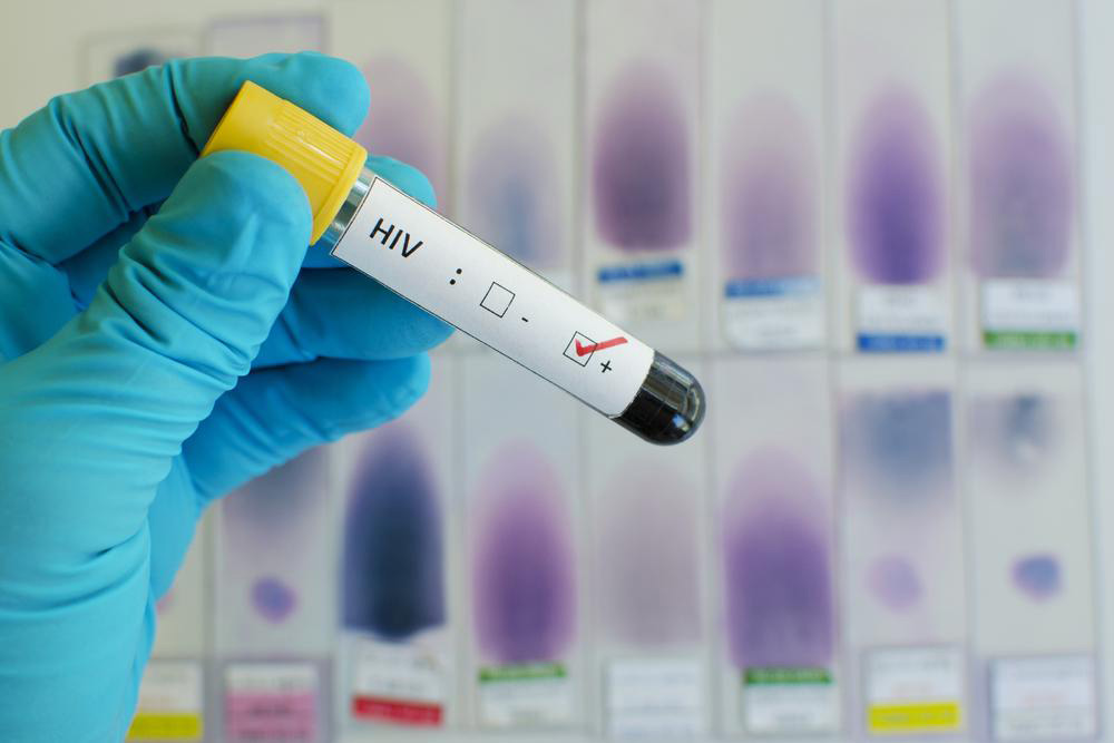 Effective Methods for HIV Testing and Diagnosis