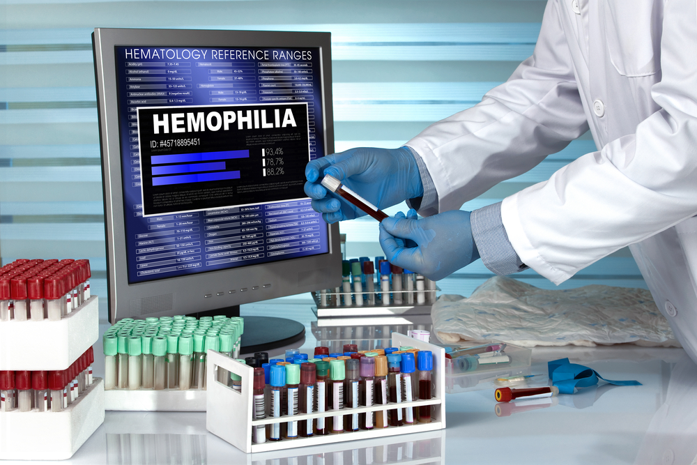 Understanding Hemophilia Types: A, B, and Their Impact
