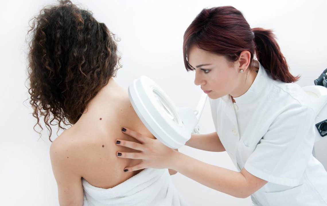 Top Strategies to Lower Melanoma Risk