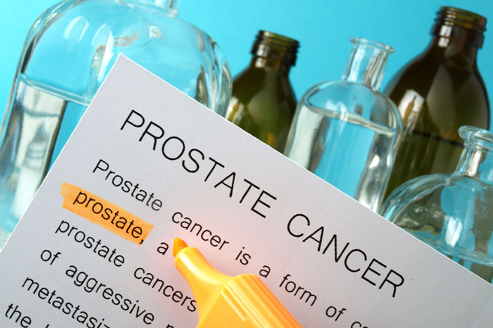 Comprehensive Guide to Recognizing Signs and Symptoms of Prostate Cancer