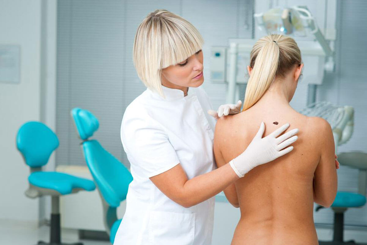Unexpected Locations Where Melanoma Signs Can Manifest