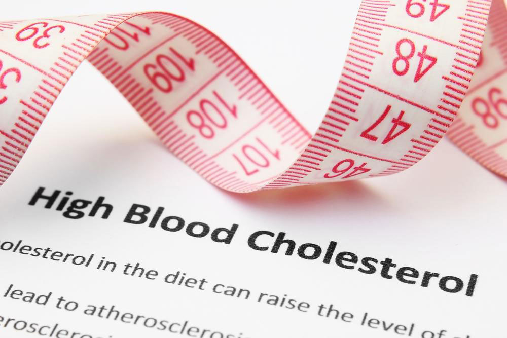 Managing High Cholesterol: Symptoms, Risks, and Treatment Strategies