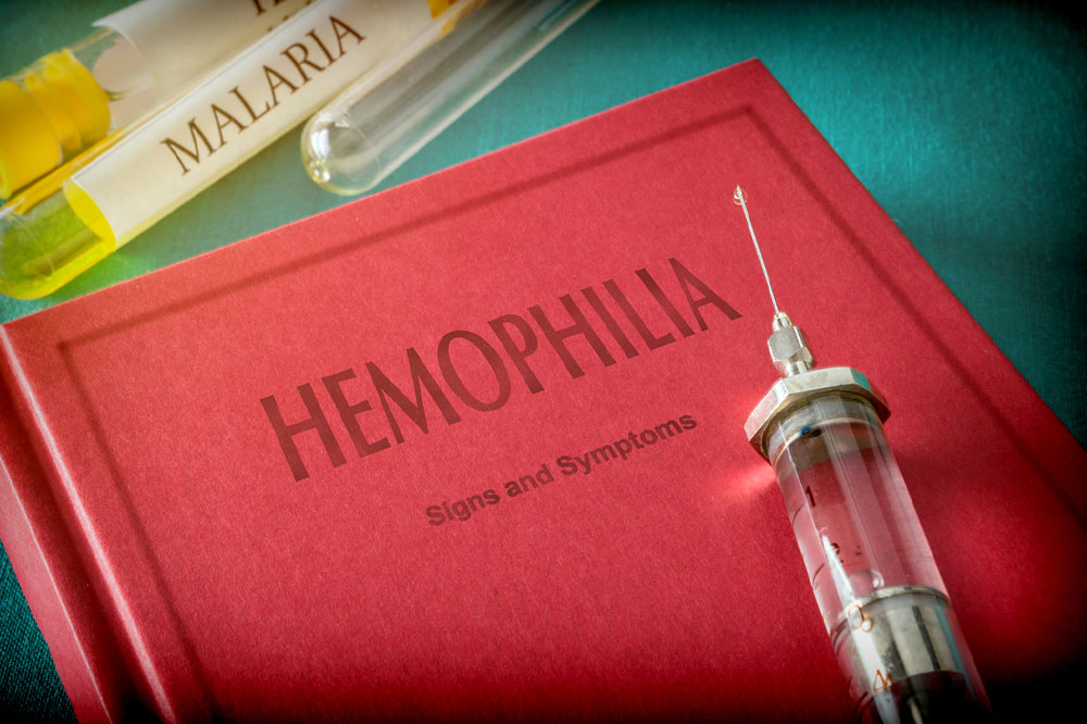 Understanding Hemophilia: Key Symptoms and Treatments