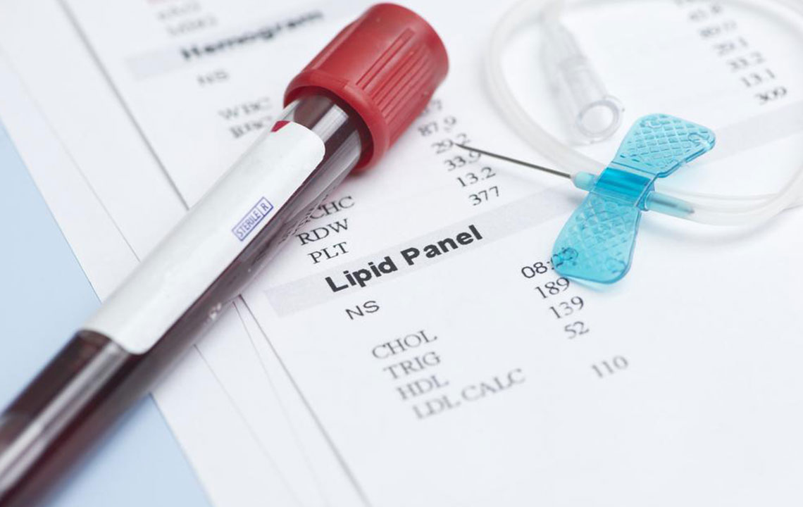 Understanding the Key Components of Your Lipid Profile