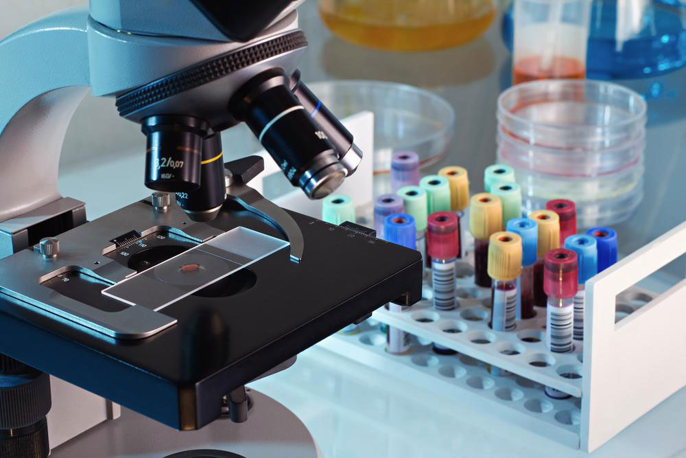 Top Affordable DNA Testing Kits for Ancestry Exploration