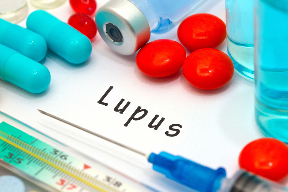 Recognizing the Early Signs of Lupus: Key Symptoms to Watch For