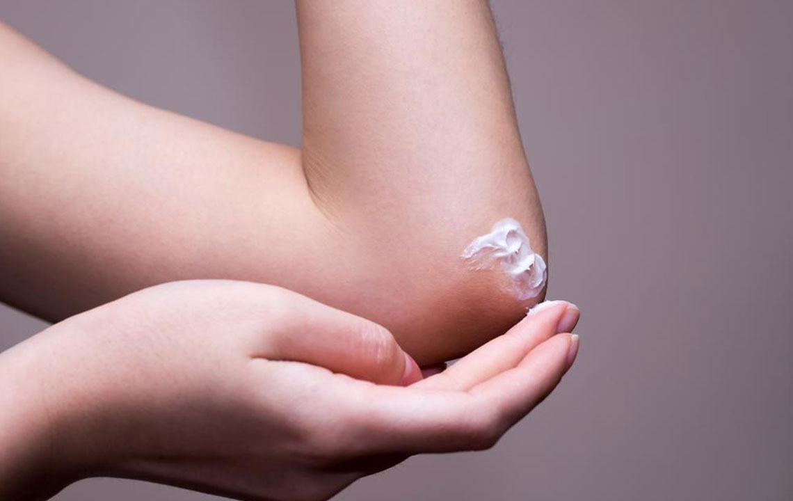 Top 10 Remedies for Effective Eczema Relief
