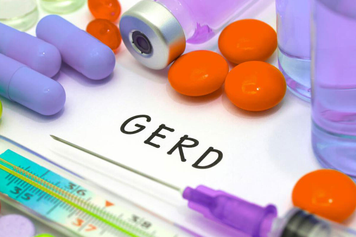 Simple Lifestyle Strategies to Alleviate GERD Symptoms Effectively