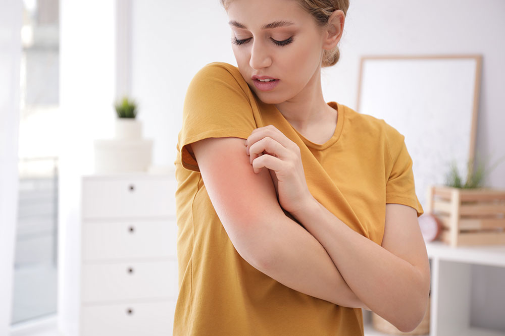 Understanding Allergies: Symptoms, Development, and Prevention