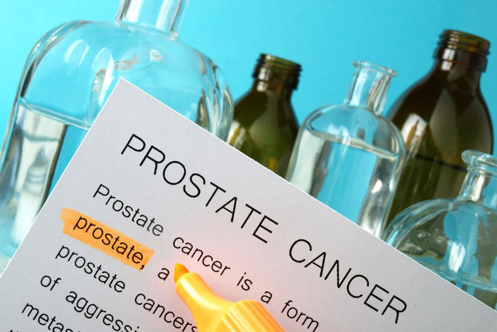 Comprehensive Overview of Advanced Prostate Cancer