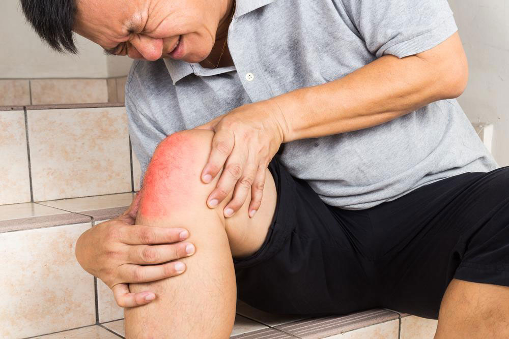 Fast-Acting Strategies to Relieve Gout Pain