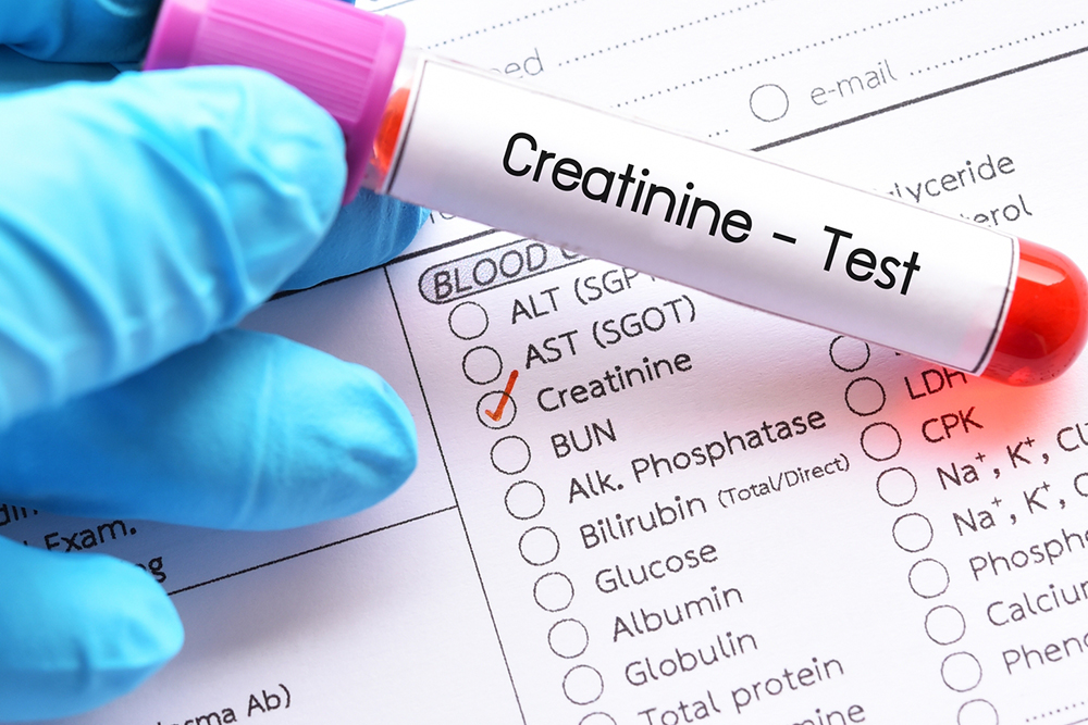 Understanding Creatinine Levels: A Guide to Interpretation