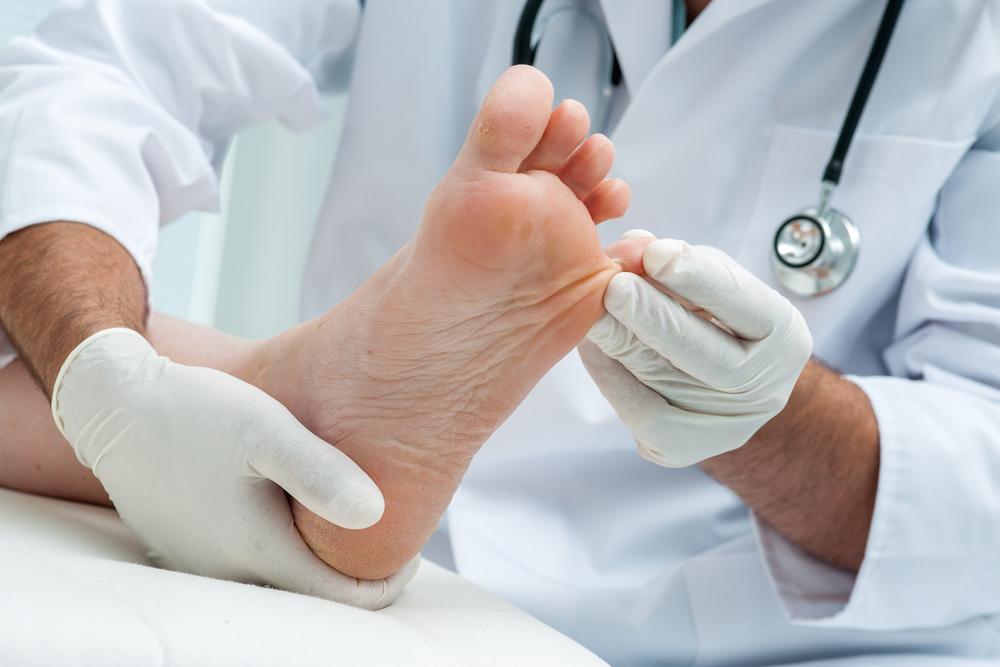 Effective Strategies for Fast Relief from Toenail Fungus