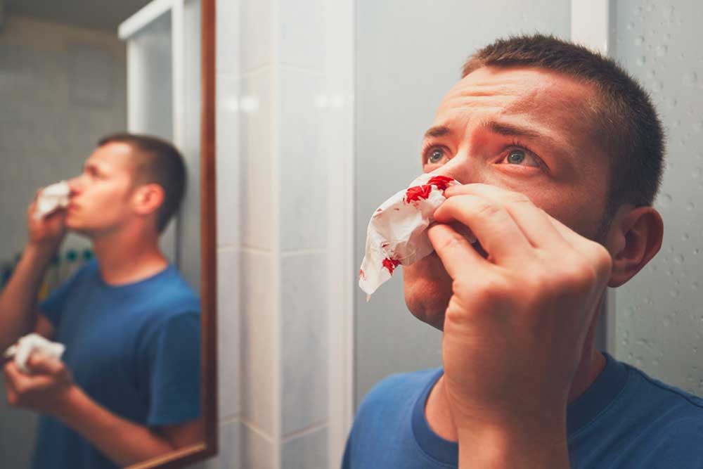Understanding Causes and Remedies for Nasal Bleeding
