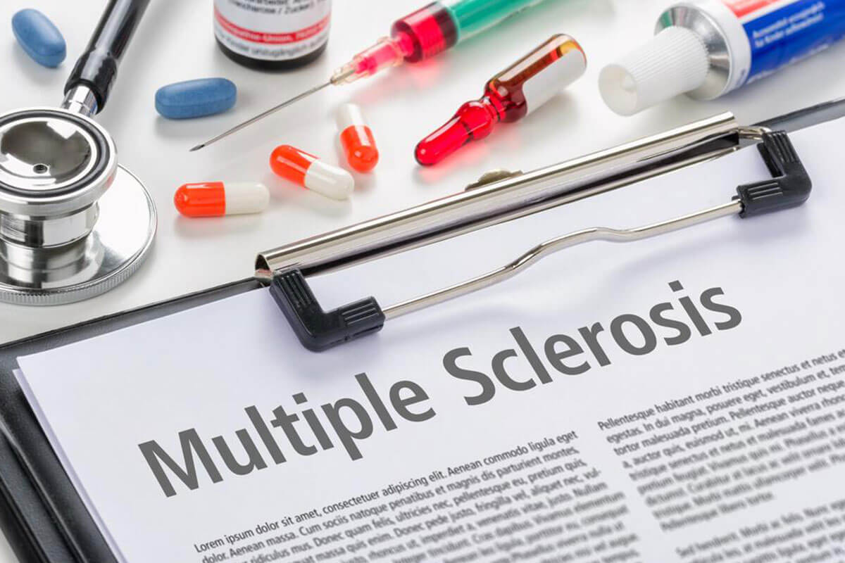 Emerging Advanced Treatments for Multiple Sclerosis