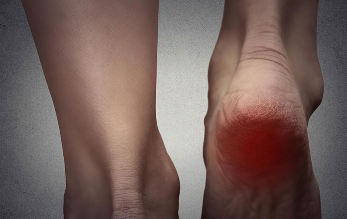 Exploring Causes and Remedies for Burning Feet Discomfort