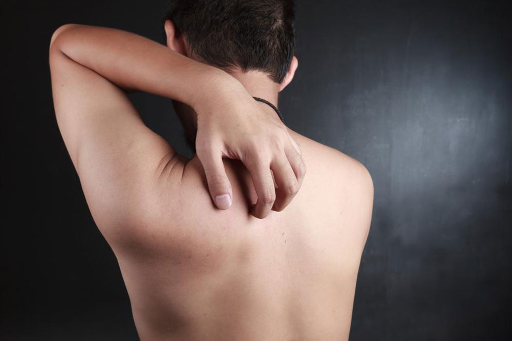 Identifying Skin Rashes Through Visual Guides and Symptoms