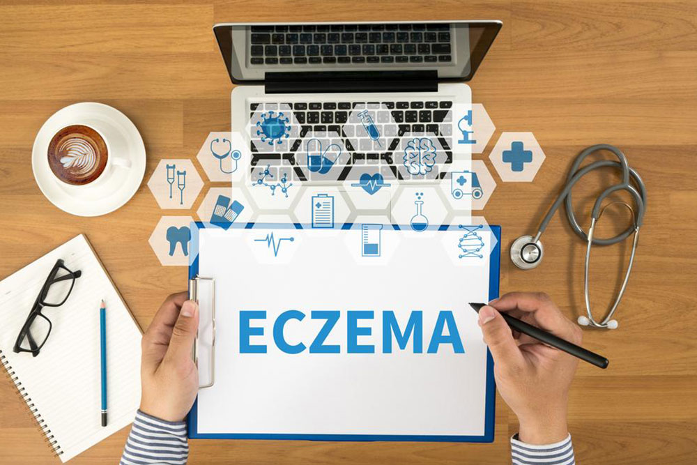 Comprehensive Guide to Managing Eczema