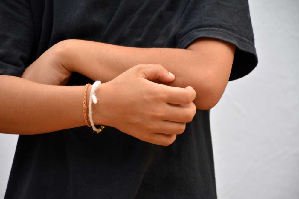 Comprehensive Guide to Itchy Skin: Causes, Treatments, and Relief Strategies