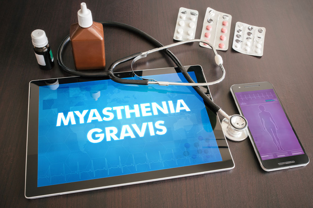 Comprehensive Guide to Myasthenia Gravis: Causes, Symptoms, and Effective Treatment Strategies