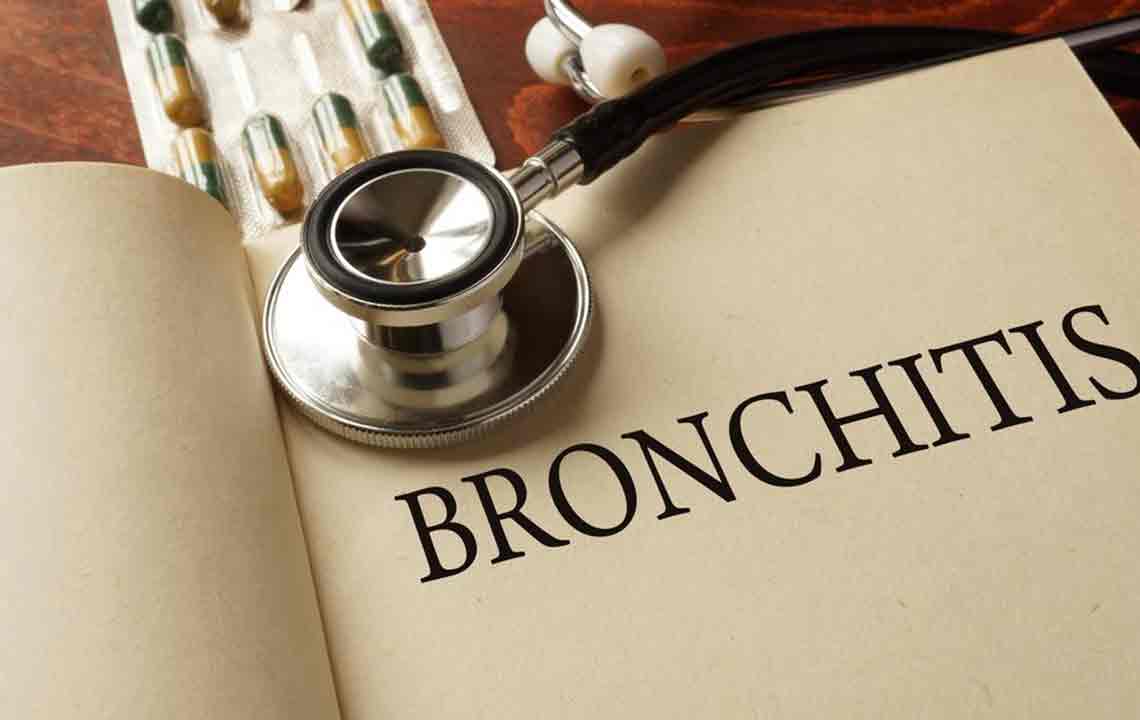 Effective Strategies for Managing Chronic Bronchitis