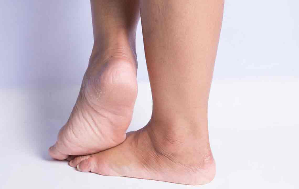 Effective Strategies to Alleviate Heel Discomfort