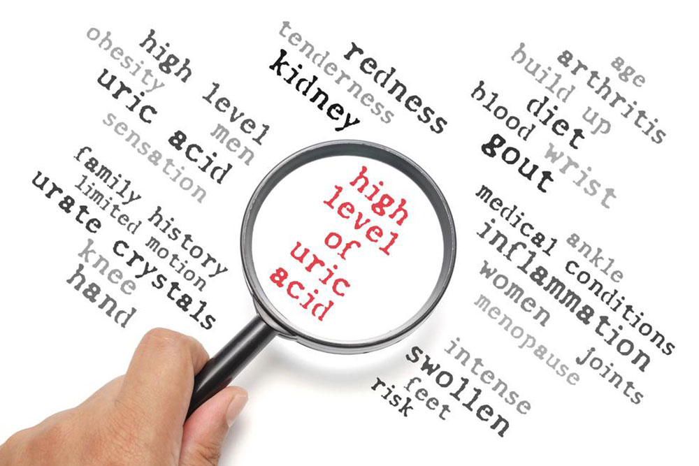 Comprehensive Guide to Managing Elevated Uric Acid Levels