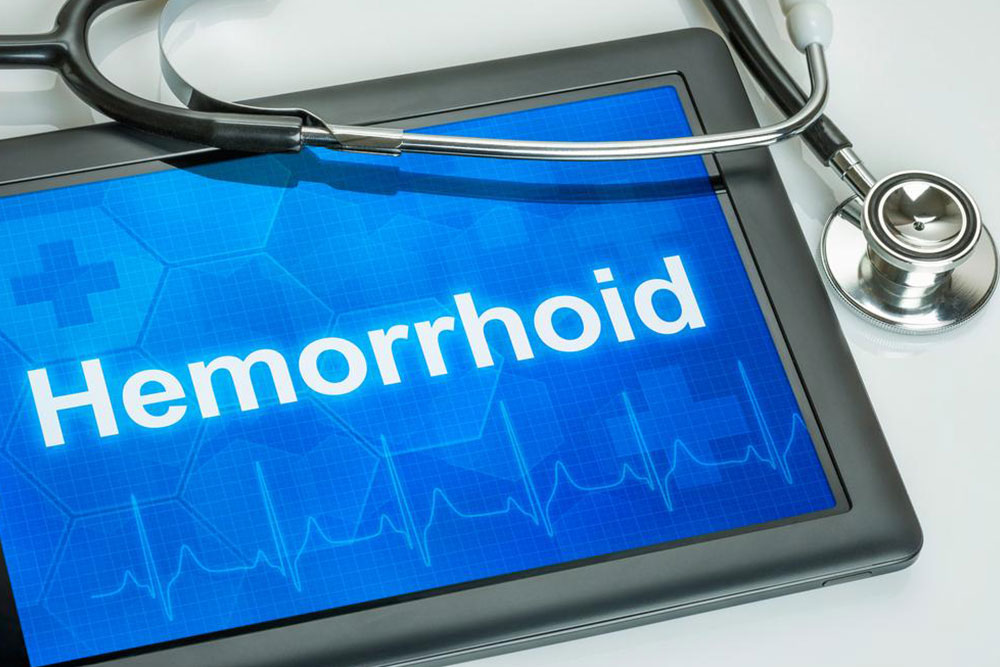 Understanding the Main Causes of Hemorrhoids