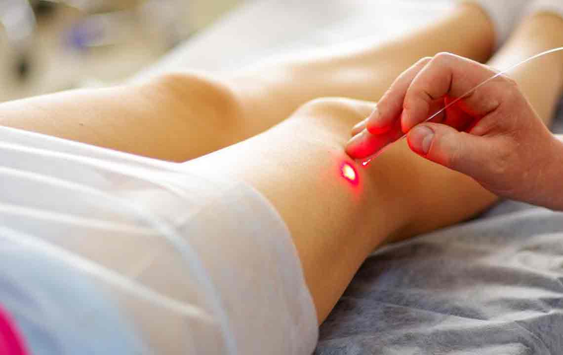 Effective Approaches to Managing Varicose Veins