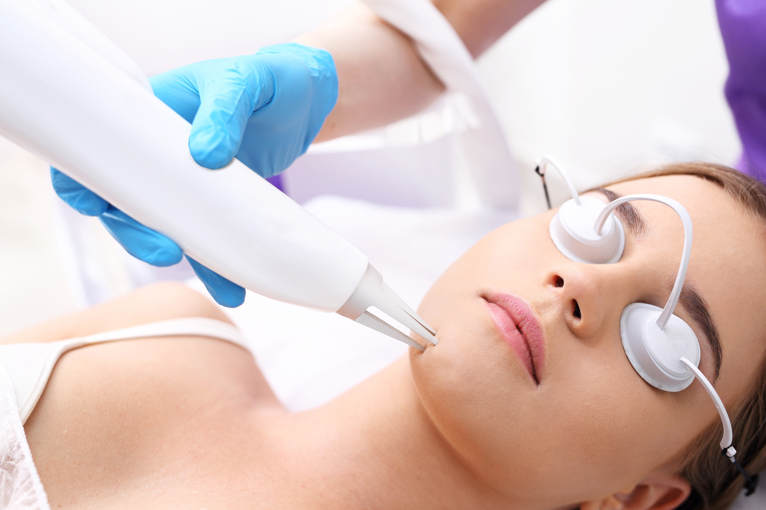 Top Options for Women’s Facial Hair Removal